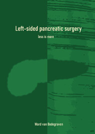 Left-sided pancreatic surgery