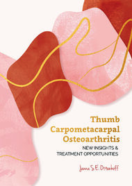 Thumb Carpometacarpal Osteoarthritis