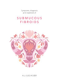 Symptoms, diagnosis and treatment of submucous fibroids