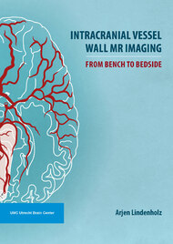 Intracranial Vessel Wall MR Imaging: