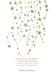 Transcatheter aortic valve implantation