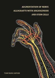 Augmentation of Nerve Allografts with Angiogenesis and Stem Cells