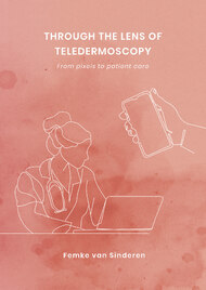 Through the lens of teledermoscopy