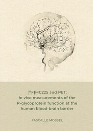 [18F]MC225 and PET: