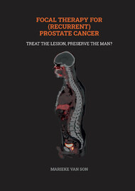 Focal therapy for (recurrent) prostate cancer