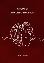 Cardiac CT in acute ischemic stroke