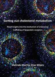 Sorting out cholesterol metabolism