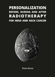 Personalization before, during and after radiotherapy for head and neck cancer