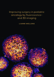 Improving surgery in pediatric oncology by fluorescence- and 3D imaging