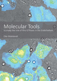 Molecular Tools to study the role of Rho GTPases in the Endothelium