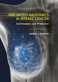 MRI-based radiomics in breast cancer