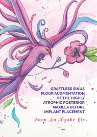 Graftless sinus floor augmentation of the highly atrophic posterior maxilla before implant placement