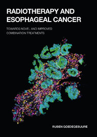 Radiotherapy and esophageal cancer