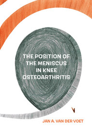 The Position of the Meniscus in Knee Osteoarthritis