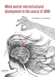 White matter microstructural development in the course of ADHD