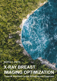 X-Ray Breast Imaging Optimization: