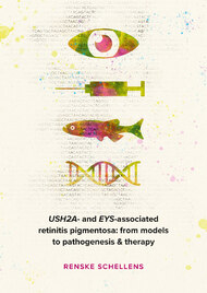 USH2A- and EYS-associated retinitis pigmentosa: from models to pathogenesis & therapy