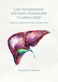 Liver Transplantation with Grafts Donated after Circulatory Death