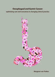 Oesophageal and Gastric Cancer: