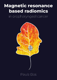 Magnetic resonance based radiomics