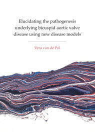 Elucidating the pathogenesis underlying bicuspid aortic valve disease using new disease models
