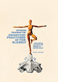 Optimizing treatment for odontoid fractures in the elderly