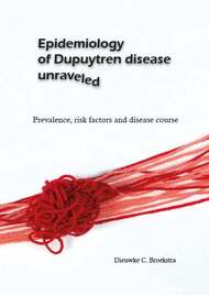 Epidemiology of Dupuytren disease unraveled