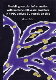 Modeling vascular inflammation with immune cell-vessel crosstalk in hiPSC-derived 3D vessels-on-chip