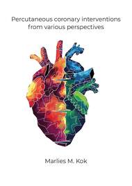 Percutaneous coronary interventions from various perspectives