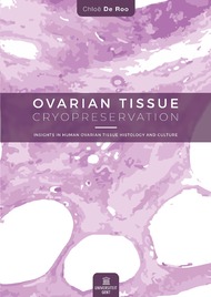 Ovarian tissue cryopreservation