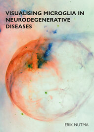 Visualising microglia in neurodegenerative diseases