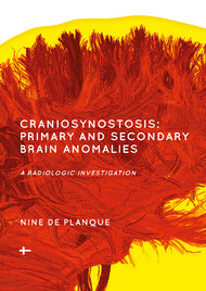 Craniosynostosis: primary and secondary brain anomalies