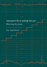 Antenatal CTG in midwife-led care