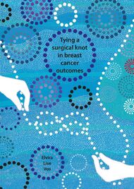 TYING A SURGICAL KNOT IN BREAST CANCER OUTCOMES