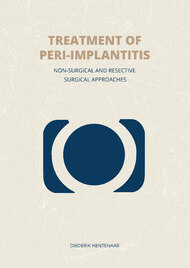 Treatment of peri-implantitis