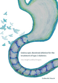 Endoscopic duodenal ablation for the treatment of type 2 diabetes