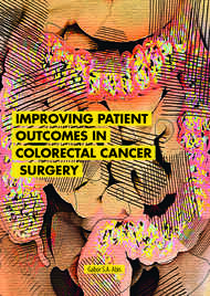 Improving patient outcomes in colorectal cancer surgery