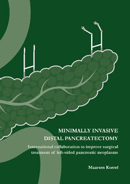 Minimally invasive distal pancreatectomy