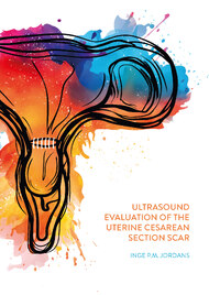 Ultrasound evaluation of the uterine cesarean section scar
