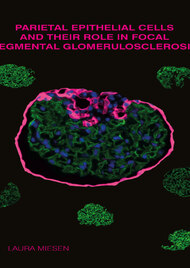 Parietal epithelial cells and their role in focal segmental glomerulosclerosis