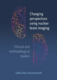 Changing perspectives using nuclear brain imaging