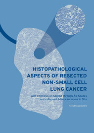 Histopathological aspects of resected non-small cell lung cancer, with emphasis on spread through air spaces and collapsed adenocarcinoma in situ