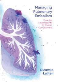 Managing Pulmonary Embolism