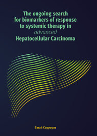 The ongoing search for biomarkers of response to systemic therapy in advanced Hepatocellular Carcinoma