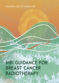 MRI guidance for breast cancer radiotherapy