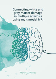 Connecting white and grey matter damage in multiple sclerosis using multimodal MRI