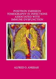 Positron Emission Tomography in infections associated with immune dysfunction 