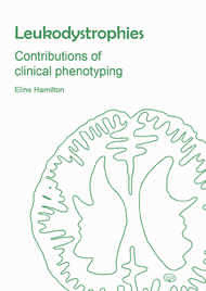 Leukodystrophies: