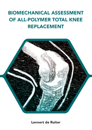 Biomechanical assessment of all-polymer total knee replacement