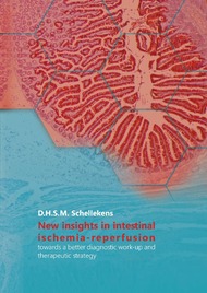 New insights in intestinal ischemia-reperfusion